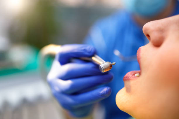 Full Mouth Reconstruction in Abbeville, SC